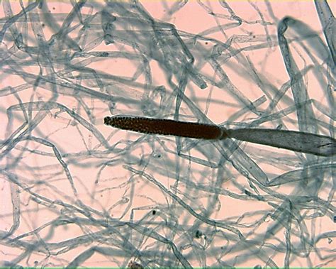  Zoosporangium: A Tiny Microscopic Wonder Hiding Secrets of Evolution!