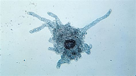  Dictyostelium: A Single-Celled Amoeba That Can Form a Multi-Cellular Slug!