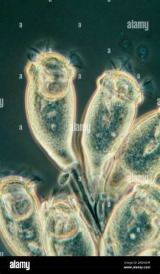  Zoothamnium!  A Glimpse into the Fascinating World of This Freshwater Ciliate